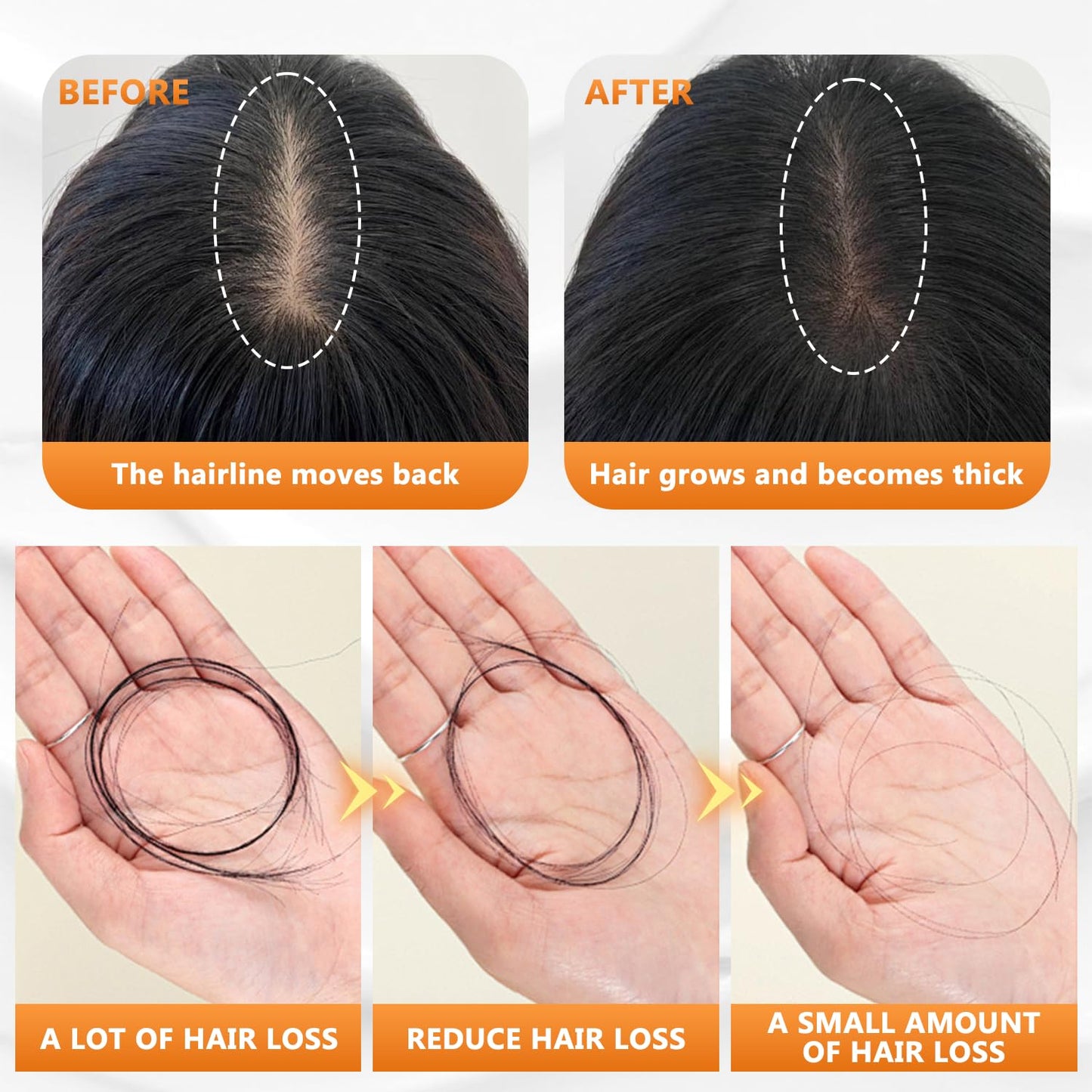 anti hair loss shampoo